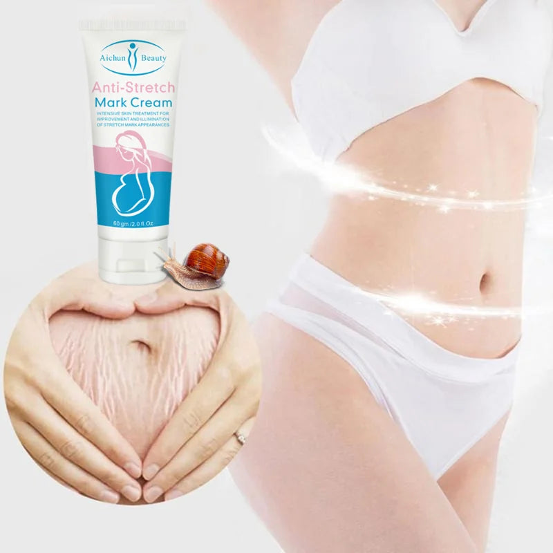 Snail Collagen Stretch Mark Cream – Firming & Skin Repair Moisturizer