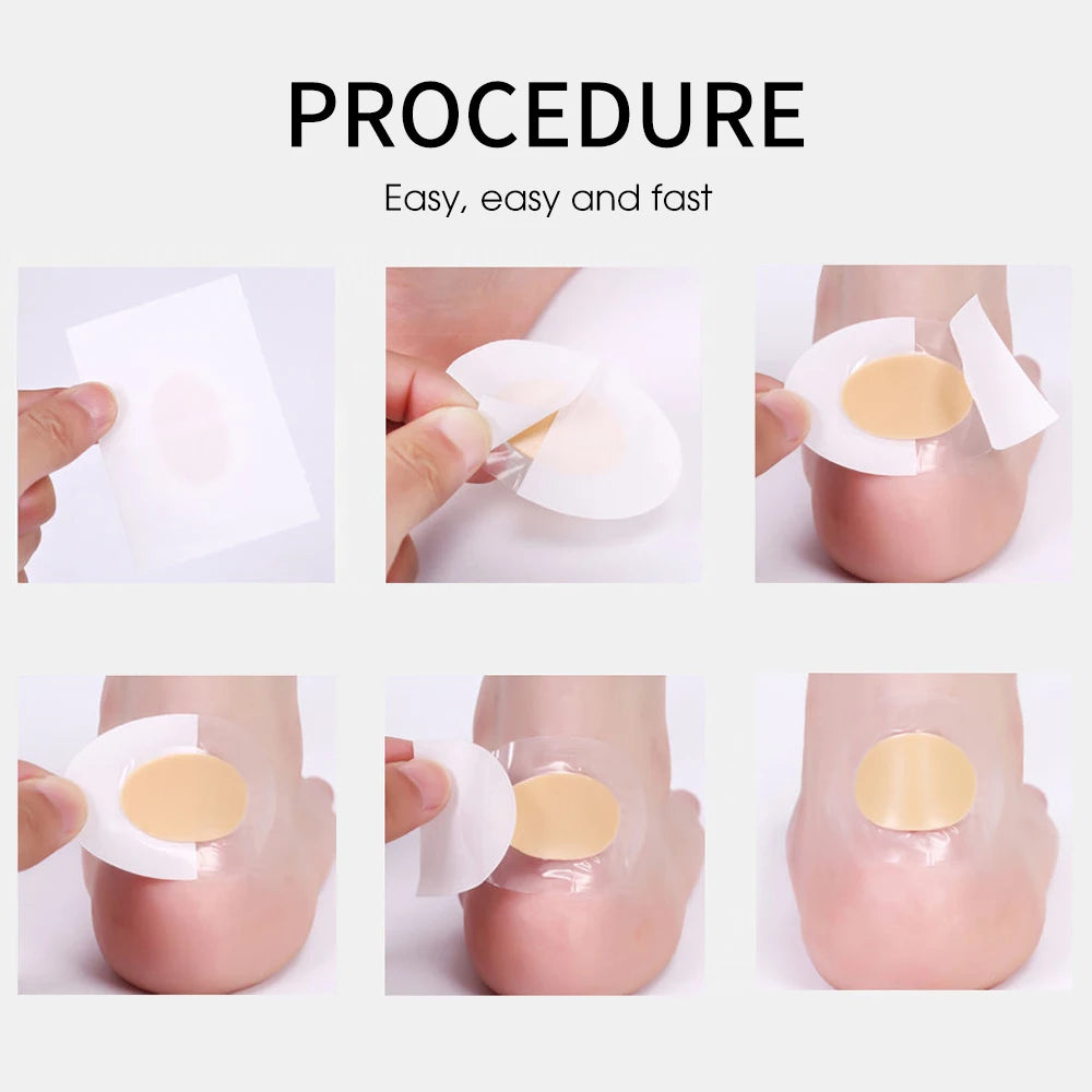 Silicone Gel Foot Protectors – Cushioned Heel Pads for Pain Relief