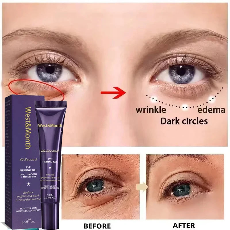 Retinol Eye Bag Cream – Brightening & Firming Under Eye Treatment
