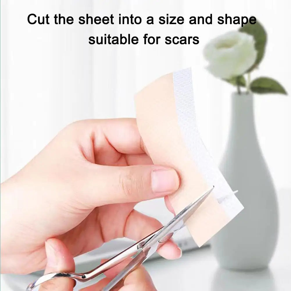 Silicone Scar Patch 4x300cm – Stretch Mark & Scar Treatment Strip