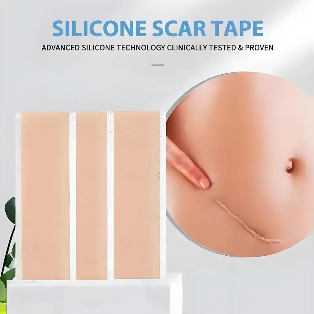 Silicone Scar Patch 4x300cm – Stretch Mark & Scar Treatment Strip