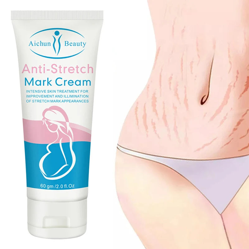 Snail Collagen Stretch Mark Cream – Firming & Skin Repair Moisturizer
