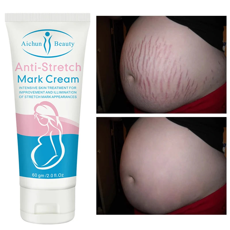 Snail Collagen Stretch Mark Cream – Firming & Skin Repair Moisturizer