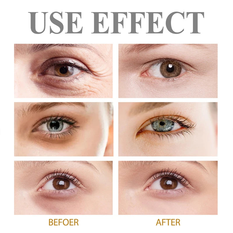 Retinol Eye Bag Cream – Brightening & Firming Under Eye Treatment