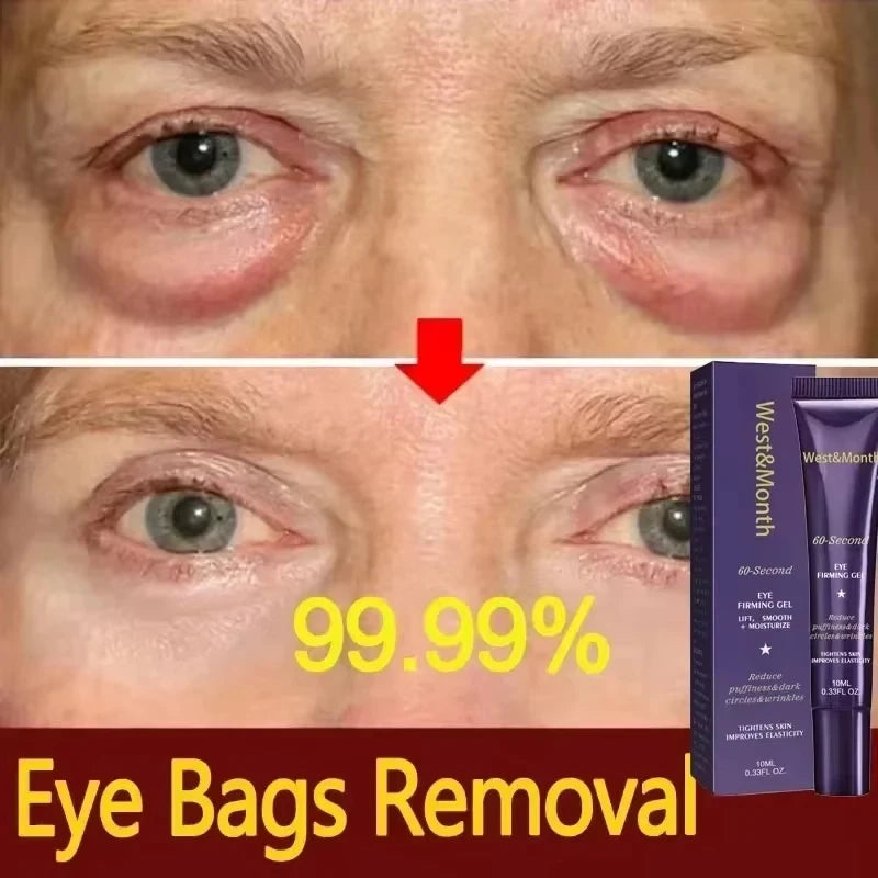 Retinol Eye Bag Cream – Brightening & Firming Under Eye Treatment