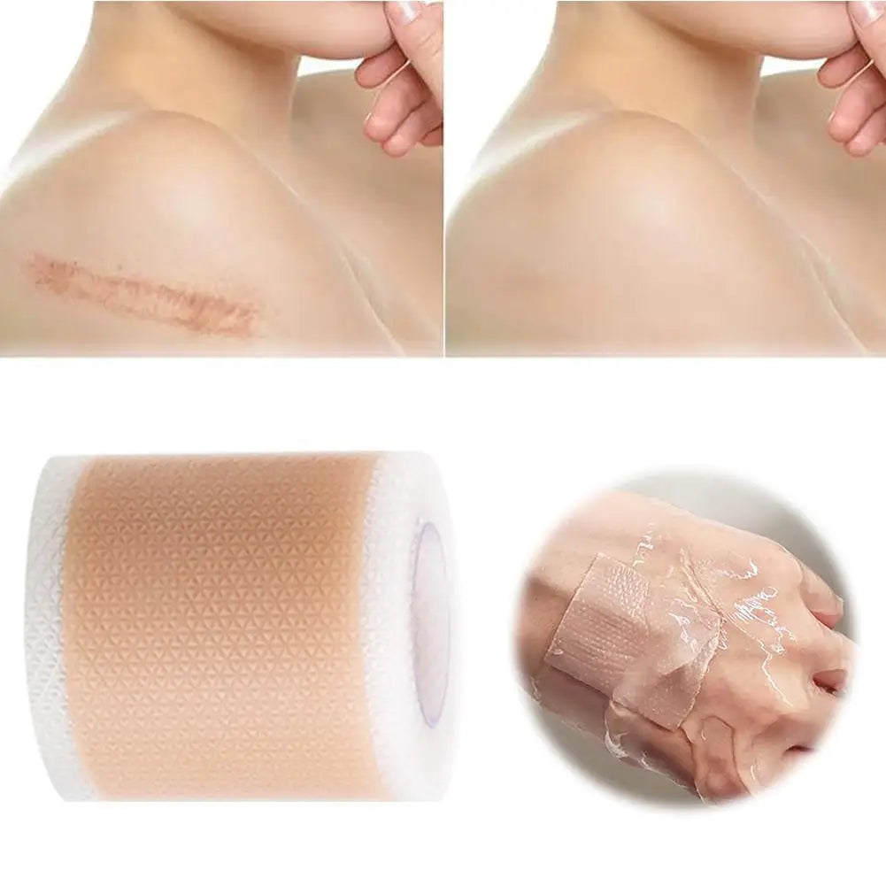 Silicone Scar Patch 4x300cm – Stretch Mark & Scar Treatment Strip